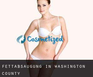 Fettabsaugung in Washington County Fettabsaugung in Washington County