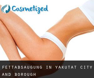 Fettabsaugung in Yakutat City and Borough Fettabsaugung in Yakutat City and Borough