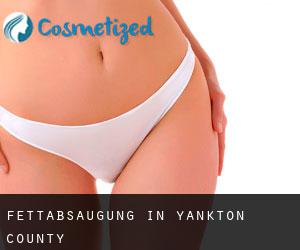 Fettabsaugung in Yankton County