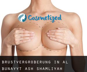 Brustvergrößerung in Al Bunayyāt ash Shamālīyah