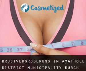 Brustvergrößerung in Amathole District Municipality durch gemeinde - Seite 6