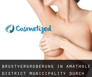 Brustvergrößerung in Amathole District Municipality durch stadt - Seite 2