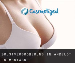 Brustvergrößerung in Andelot-en-Montagne