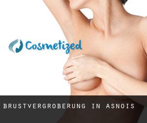 Brustvergrößerung in Asnois