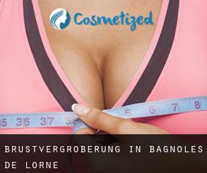 Brustvergrößerung in Bagnoles-de-l'Orne