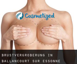 Brustvergrößerung in Ballancourt-sur-Essonne