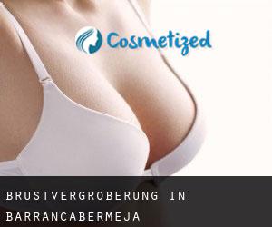 Brustvergrößerung in Barrancabermeja