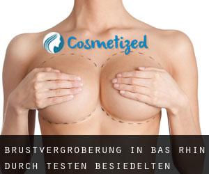 Brustvergrößerung in Bas-Rhin durch testen besiedelten gebiet - Seite 2