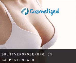 Brustvergrößerung in Baumerlenbach