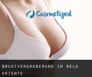 Brustvergrößerung in Belo Oriente