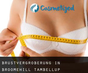 Brustvergrößerung in Broomehill-Tambellup
