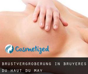 Brustvergrößerung in Bruyères-du-Haut-du-May