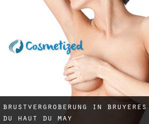 Brustvergrößerung in Bruyères-du-Haut-du-May