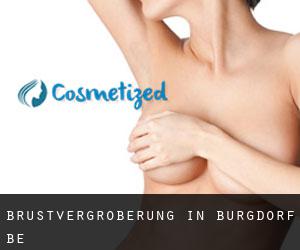 Brustvergrößerung in Burgdorf BE