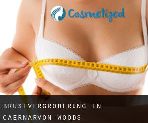 Brustvergrößerung in Caernarvon Woods