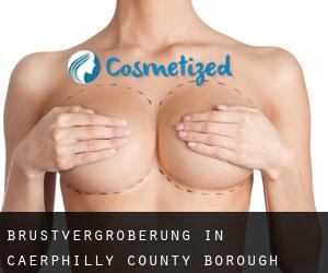 Brustvergrößerung in Caerphilly (County Borough) durch stadt - Seite 1