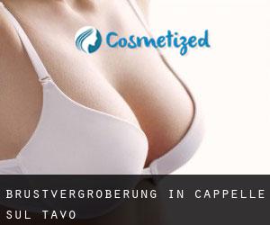 Brustvergrößerung in Cappelle sul Tavo