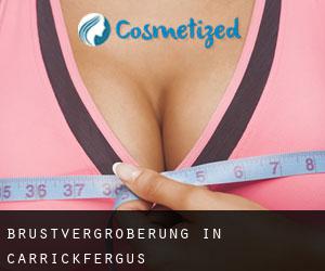 Brustvergrößerung in Carrickfergus Brustvergrößerung in Carrickfergus