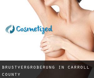 Brustvergrößerung in Carroll County