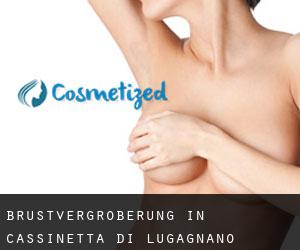 Brustvergrößerung in Cassinetta di Lugagnano