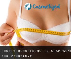Brustvergrößerung in Champagne-sur-Vingeanne