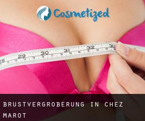 Brustvergrößerung in Chez Marot Brustvergrößerung in Chez Marot