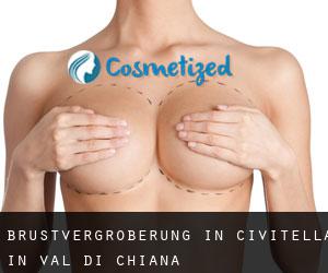 Brustvergrößerung in Civitella in Val di Chiana