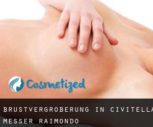 Brustvergrößerung in Civitella Messer Raimondo