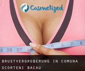 Brustvergrößerung in Comuna Scorţeni (Bacău)