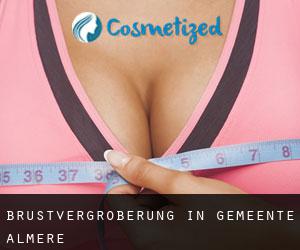 Brustvergrößerung in Gemeente Almere
