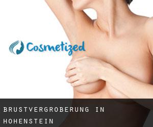 Brustvergrößerung in Hohenstein