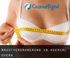 Brustvergrößerung in Huercal Overa Brustvergrößerung in Huercal Overa