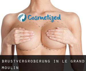 Brustvergrößerung in Le Grand Moulin Brustvergrößerung in Le Grand Moulin