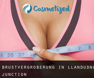 Brustvergrößerung in Llandudno Junction