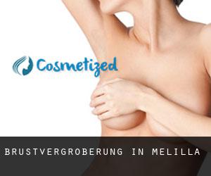Brustvergrößerung in Melilla Brustvergrößerung in Melilla