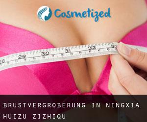Brustvergrößerung in Ningxia Huizu Zizhiqu