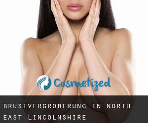 Brustvergrößerung in North East Lincolnshire