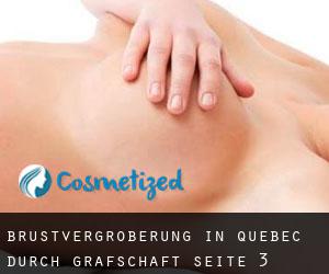 Brustvergrößerung in Quebec durch Grafschaft - Seite 3