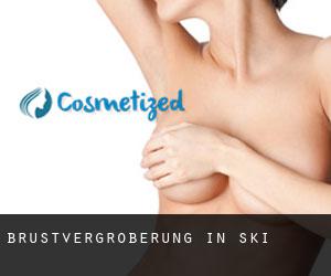 Brustvergrößerung in Şǝki Brustvergrößerung in Şǝki
