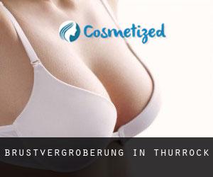 Brustvergrößerung in Thurrock Brustvergrößerung in Thurrock