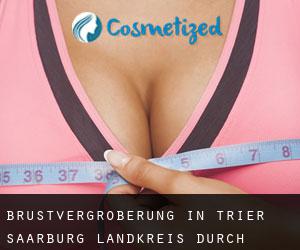 Brustvergrößerung in Trier-Saarburg Landkreis durch hauptstadt - Seite 1