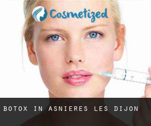 Botox in Asnières-lès-Dijon