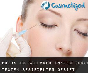 Botox in Balearen Inseln durch testen besiedelten gebiet - Seite 2