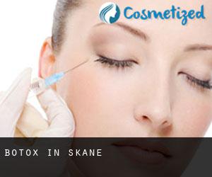 Botox in Skåne Botox in Skåne