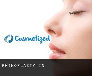 Rhinoplasty in 연천군 Rhinoplasty in 연천군