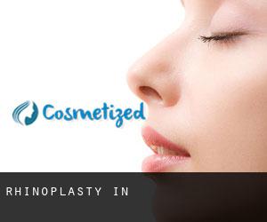 Rhinoplasty in 연천군