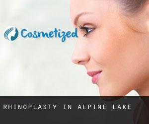 Rhinoplasty in Alpine Lake