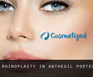 Rhinoplasty in Antheuil-Portes