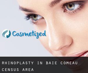 Rhinoplasty in Baie-Comeau (census area)