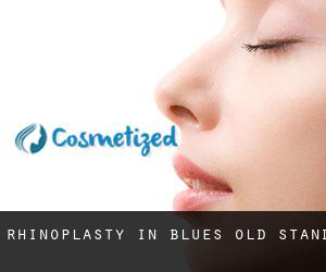 Rhinoplasty in Blues Old Stand